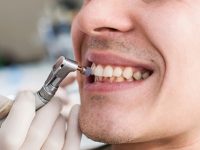 Tips to Select the Best Cosmetic Dentist in Barcelona